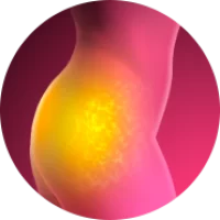 celulite.webp celulite.webp